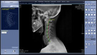 Vatech - ChiroVIEW Software